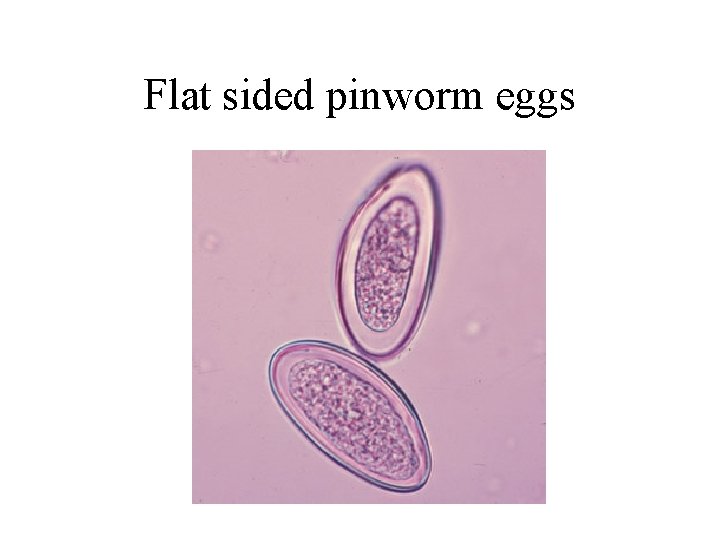 Flat sided pinworm eggs Flat sided pinworm eggs