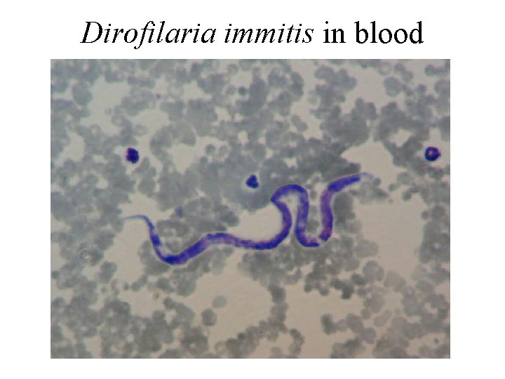 Dirofilaria immitis in blood Dirofilaria immitis in blood
