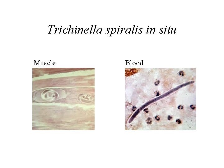 Trichinella spiralis in situ Muscle Blood Trichinella spiralis in situ Muscle Blood