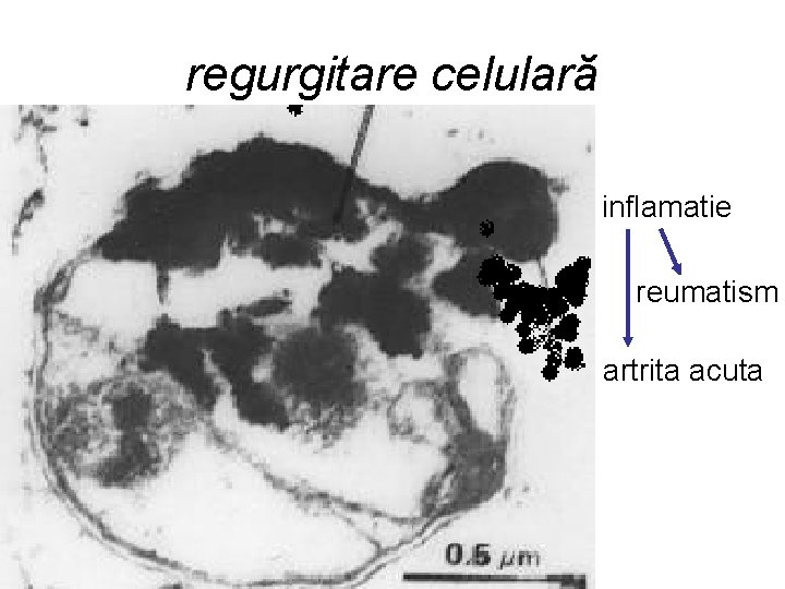 regurgitare celulară inflamatie reumatism artrita acuta 