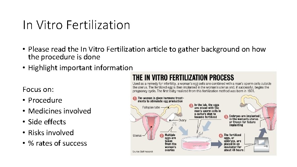 In Vitro Fertilization • Please read the In Vitro Fertilization article to gather background