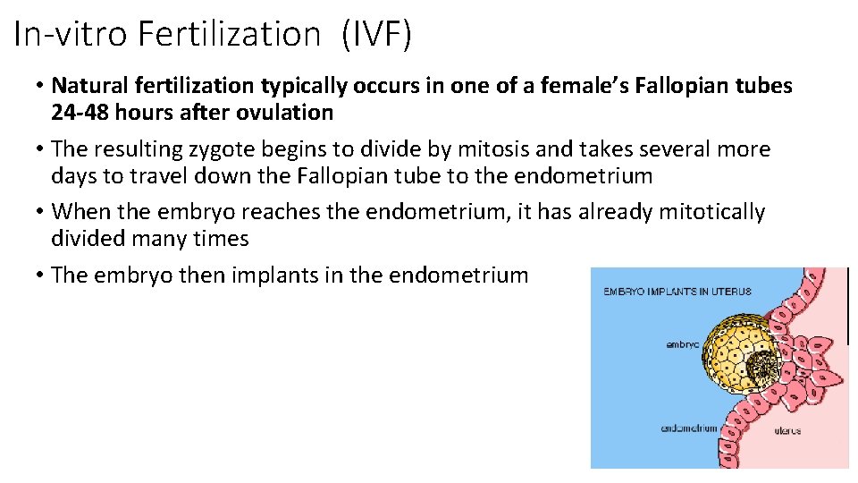 In-vitro Fertilization (IVF) • Natural fertilization typically occurs in one of a female’s Fallopian