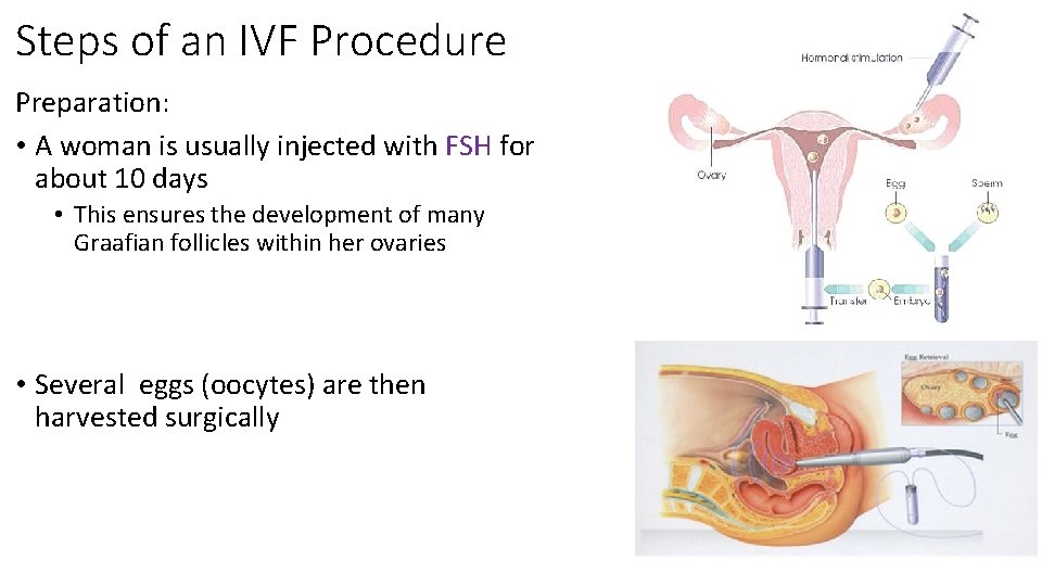 Steps of an IVF Procedure Preparation: • A woman is usually injected with FSH