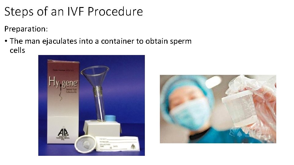 Steps of an IVF Procedure Preparation: • The man ejaculates into a container to