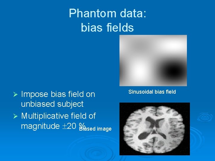 Phantom data: bias fields Impose bias field on unbiased subject Ø Multiplicative field of