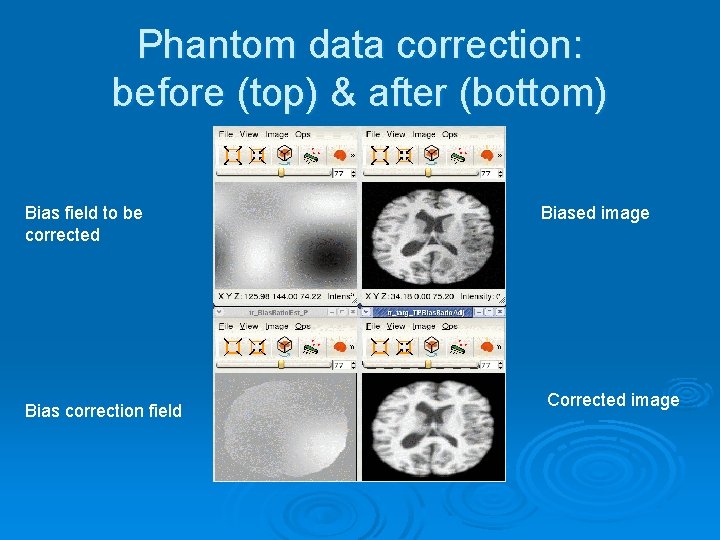 Phantom data correction: before (top) & after (bottom) Bias field to be corrected Bias