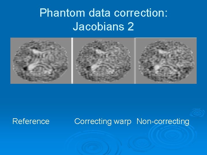 Phantom data correction: Jacobians 2 Reference Correcting warp Non-correcting 