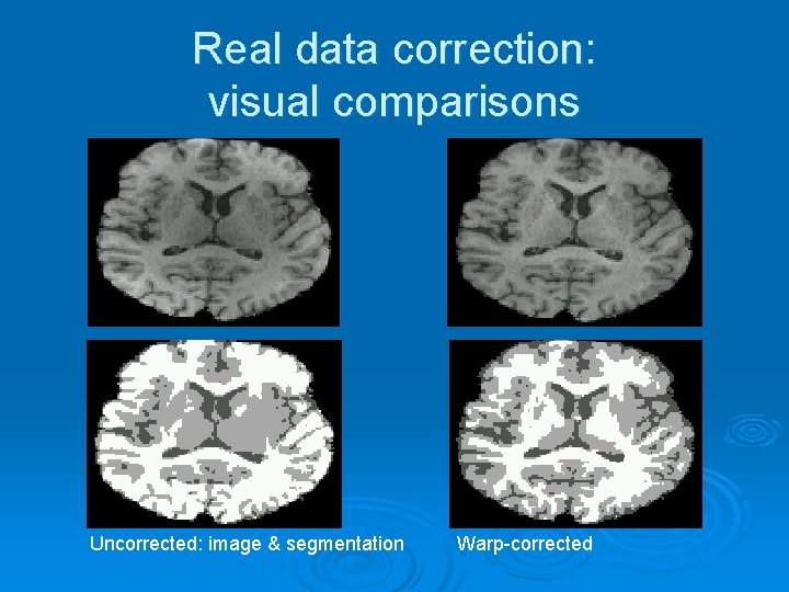 Real data correction: visual comparisons Uncorrected: image & segmentation Warp-corrected 