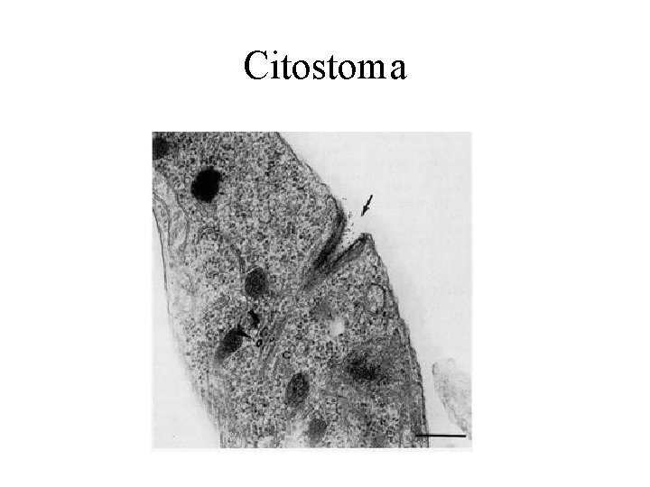 Citostoma 