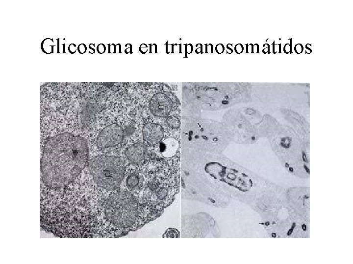 Glicosoma en tripanosomátidos 