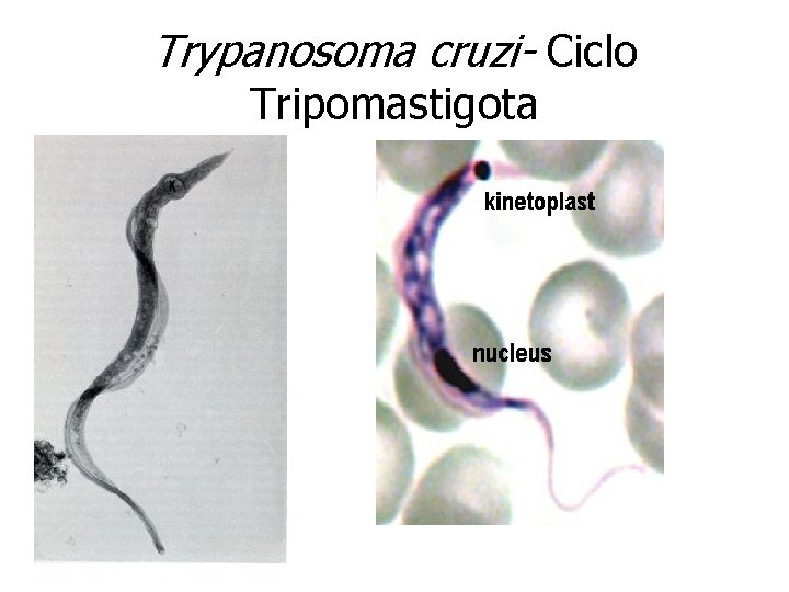 Trypanosoma cruzi- Ciclo Tripomastigota 