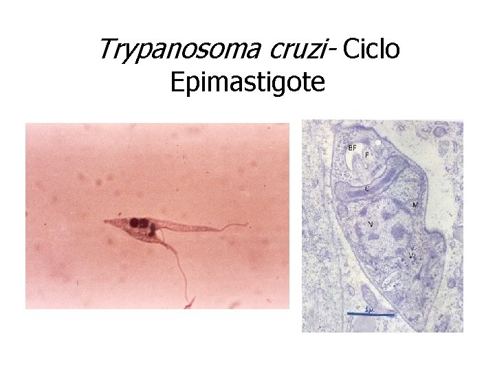 Trypanosoma cruzi- Ciclo Epimastigote 