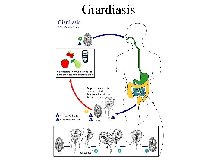 Giardiasis 
