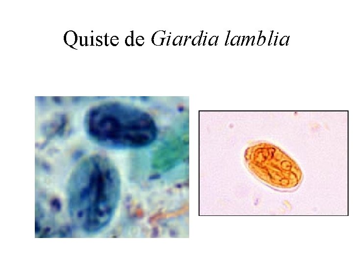 Quiste de Giardia lamblia 
