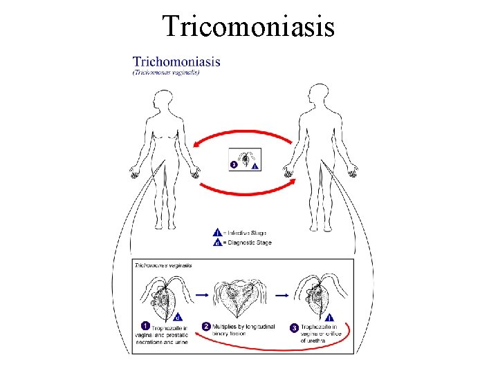Tricomoniasis 