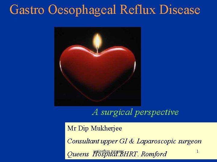 Gastro Oesophageal Reflux Disease A surgical perspective Mr Dip Mukherjee Consultant upper GI &