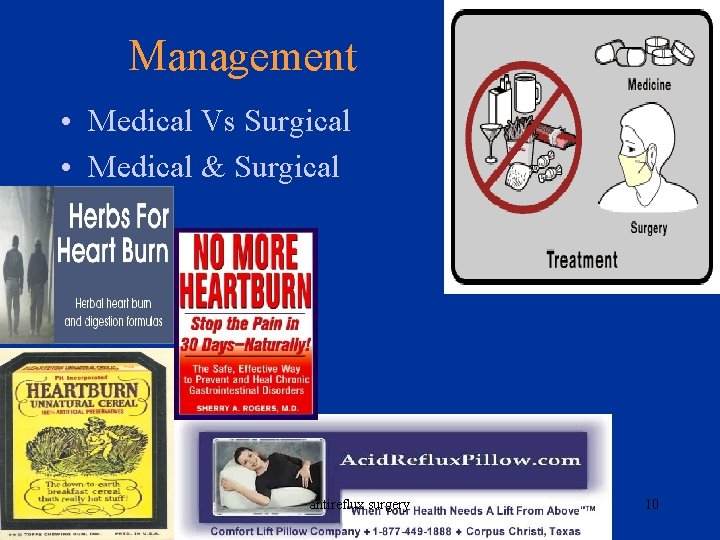 Management • Medical Vs Surgical • Medical & Surgical antireflux surgery 10 