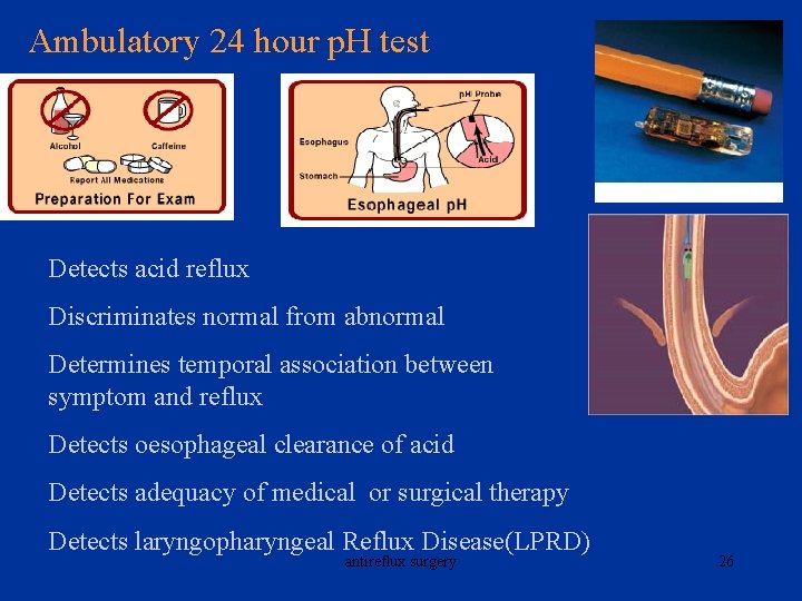 Ambulatory 24 hour p. H test Detects acid reflux Discriminates normal from abnormal Determines