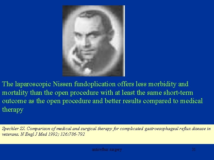 The laparoscopic Nissen fundoplication offers less morbidity and mortality than the open procedure with