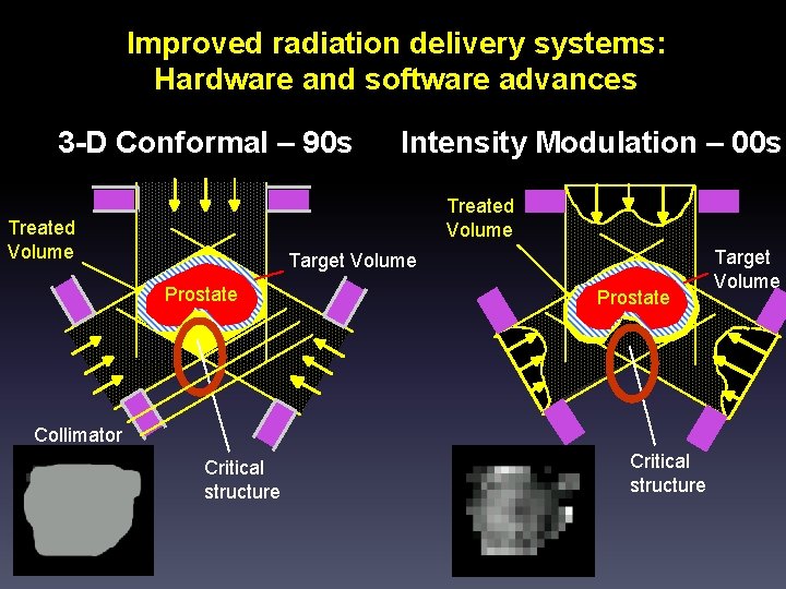 Improved radiation delivery systems: Hardware and software advances 3 -D Conformal – 90 s