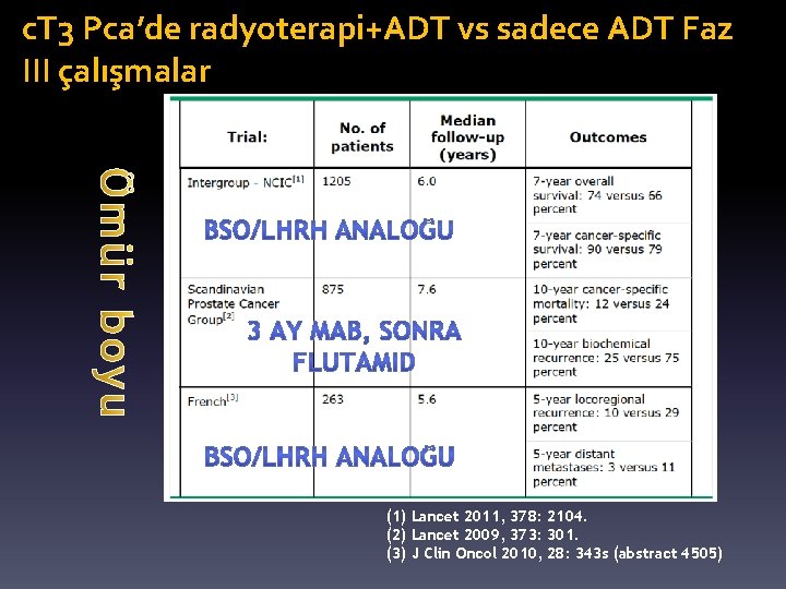 c. T 3 Pca’de radyoterapi+ADT vs sadece ADT Faz III çalışmalar (1) Lancet 2011,