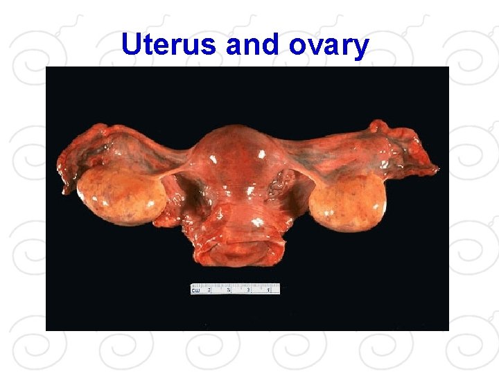 Uterus and ovary 