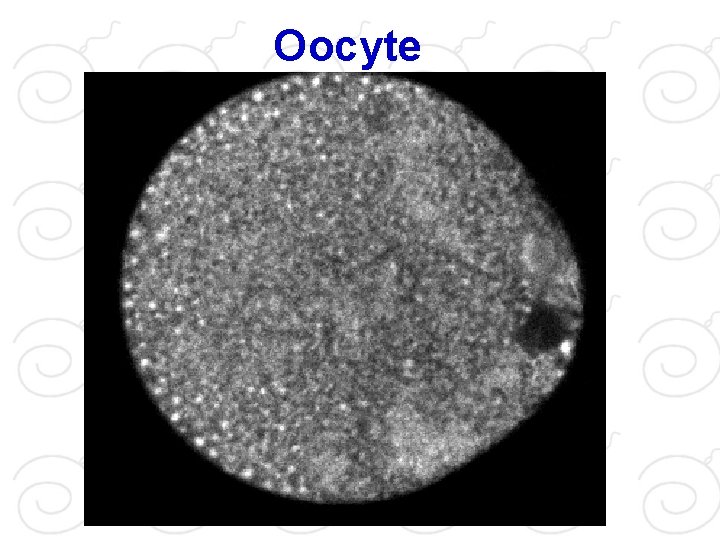 Oocyte 