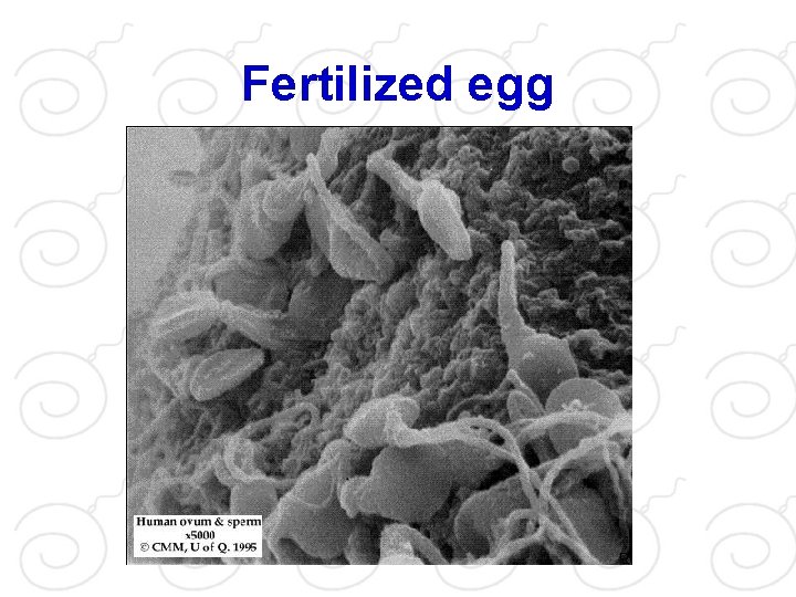 Fertilized egg 