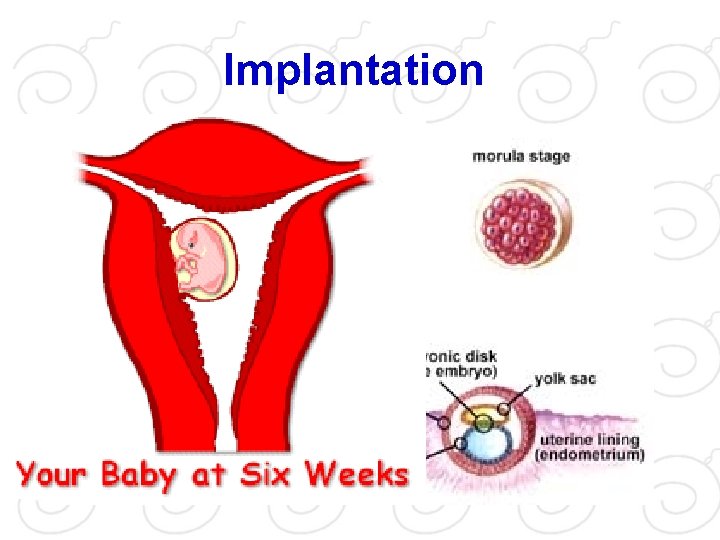 Implantation 