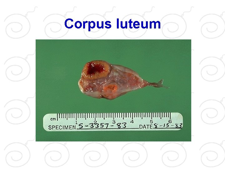 Corpus luteum 