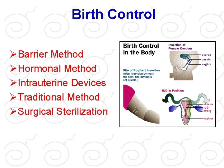 Birth Control ØBarrier Method ØHormonal Method ØIntrauterine Devices ØTraditional Method ØSurgical Sterilization 