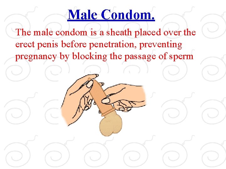 Male Condom. The male condom is a sheath placed over the erect penis before