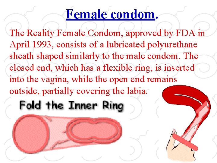 Female condom. The Reality Female Condom, approved by FDA in April 1993, consists of