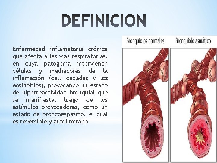 Enfermedad inflamatoria crónica que afecta a las vías respiratorias, en cuya patogenia intervienen células