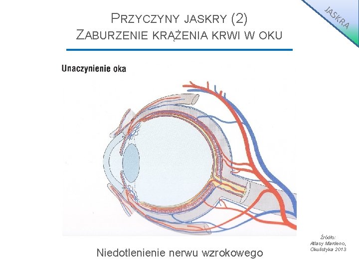 PRZYCZYNY JASKRY (2) ZABURZENIE KRĄŻENIA KRWI W OKU Niedotlenienie nerwu wzrokowego JA S KR PRZYCZYNY JASKRY (2) ZABURZENIE KRĄŻENIA KRWI W OKU Niedotlenienie nerwu wzrokowego JA S KR