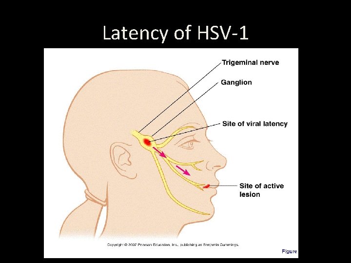 Latency of HSV-1 