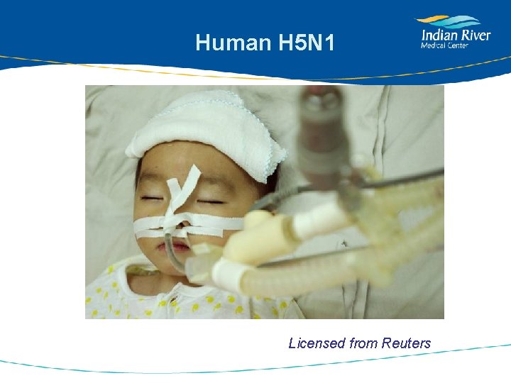 Human H 5 N 1 Licensed from Reuters 