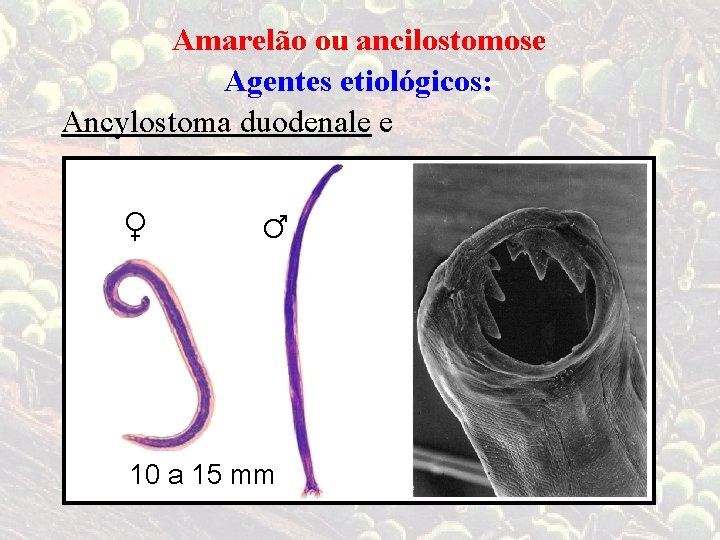 Amarelão ou ancilostomose Agentes etiológicos: Ancylostoma duodenale e ♀ ♂ 10 a 15 mm