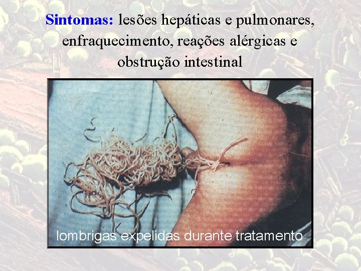 Sintomas: lesões hepáticas e pulmonares, enfraquecimento, reações alérgicas e obstrução intestinal lombrigas expelidas durante