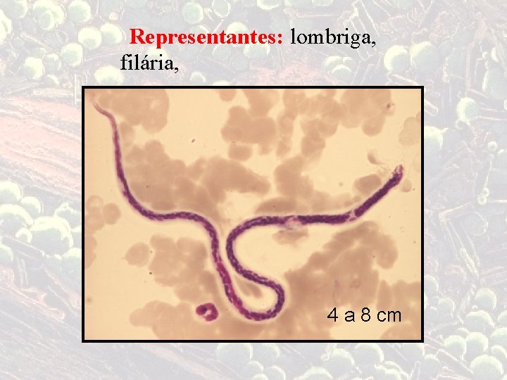 Representantes: lombriga, filária, 4 a 8 cm 