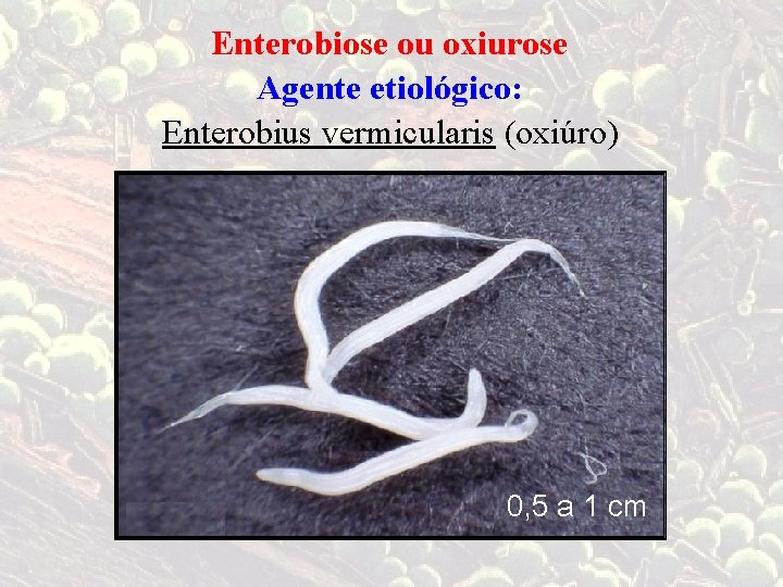 Enterobiose ou oxiurose Agente etiológico: Enterobius vermicularis (oxiúro) 0, 5 a 1 cm 