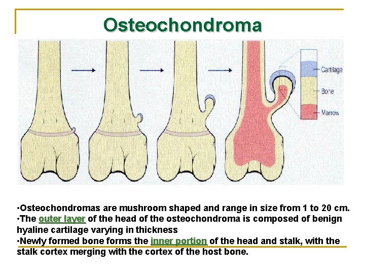 Osteochondroma Morphology • Osteochondromas are mushroom shaped and range in size from 1 to
