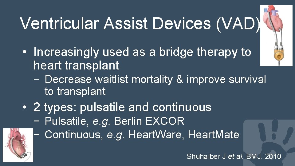 Ventricular Assist Devices (VAD) • Increasingly used as a bridge therapy to heart transplant