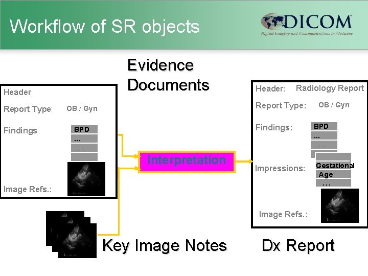 Workflow of SR objects Evidence Documents Header: Report Type: Findings: Header: Radiology Report Type: