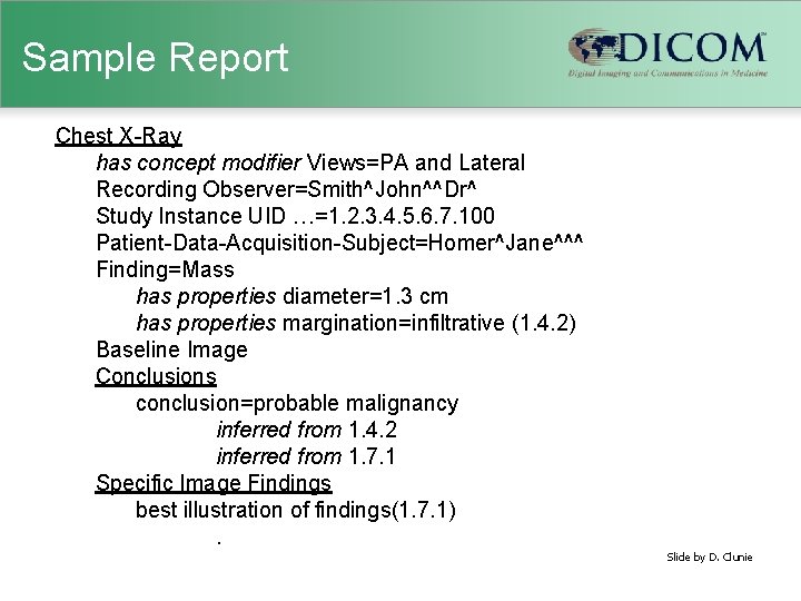 Sample Report Chest X-Ray has concept modifier Views=PA and Lateral Recording Observer=Smith^John^^Dr^ Study Instance