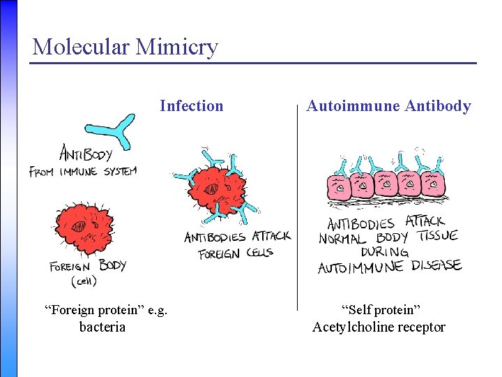 Molecular Mimicry Infection Autoimmune Antibody “Foreign protein” e. g. “Self protein” bacteria Acetylcholine receptor