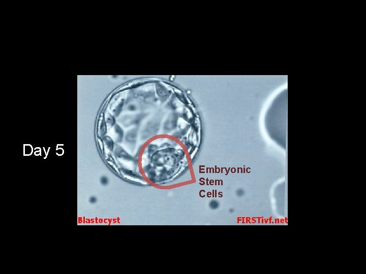 Day 5 Embryonic Stem Cells 