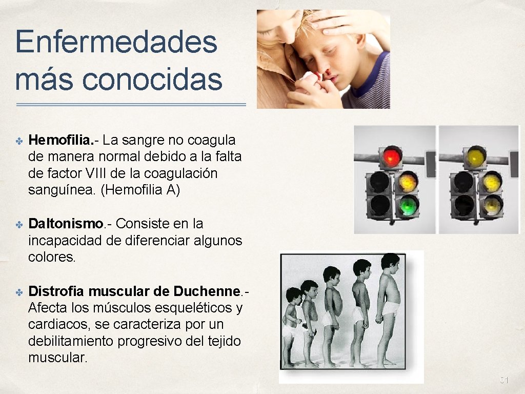 Enfermedades más conocidas ✤ Hemofilia. - La sangre no coagula de manera normal debido