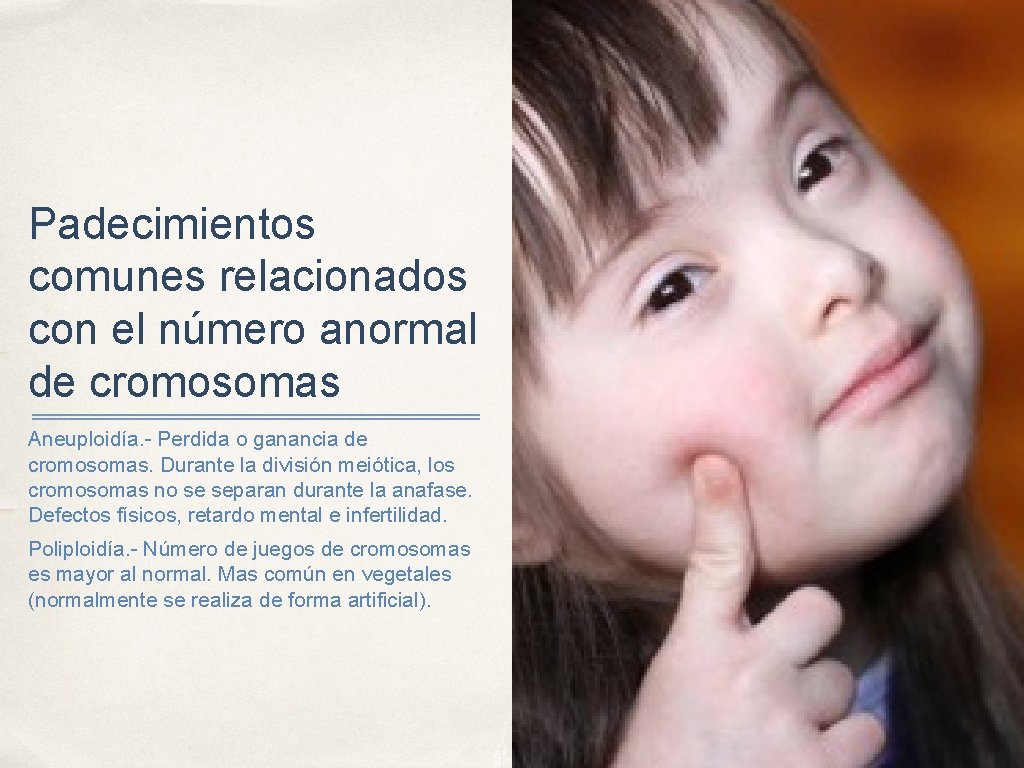 Padecimientos comunes relacionados con el número anormal de cromosomas Aneuploidía. - Perdida o ganancia