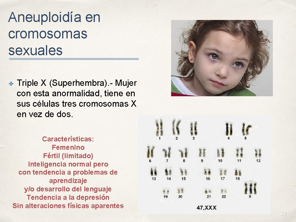 Aneuploidía en cromosomas sexuales ✤ Triple X (Superhembra). - Mujer con esta anormalidad, tiene